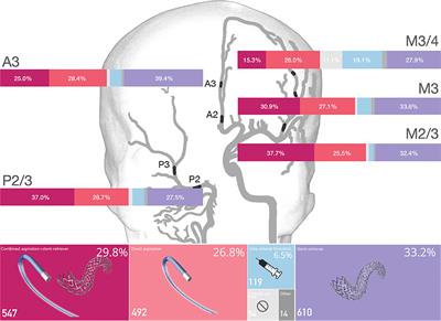 Endovascular Device Choice and Tools for Recanalization of Medium Vessel Occlusions: Insights From the MeVO FRONTIERS International Survey